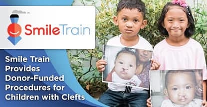 Smile Train Provides Donor Funded Procedures For Children With Clefts