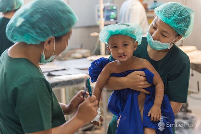 Image of a Smile Train-funded procedure to repair a cleft lip Image of a Smile Train-funded procedure to repair a cleft lip