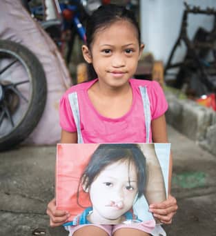 Image of a child in the Philippines helped by Smile Train